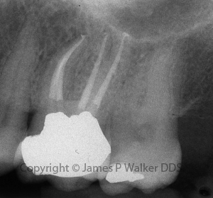 Post-Treatment Evaluation Film